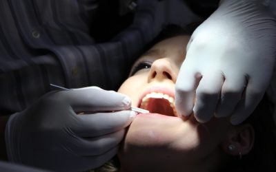 Un traitement pour l’Alzheimer qui restaure les dents