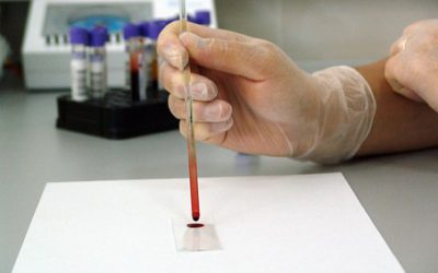 Le test révolutionnaire qui affiche votre groupe sanguin en 30 secondes