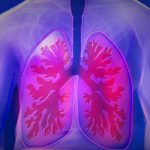 Les infections pulmonaires : causes, conséquences, typologie…